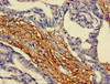 ARAP3 Antibody PACO52542