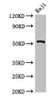 BLNK Antibody PACO52626