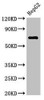 ST6GALNAC1 Antibody PACO52758