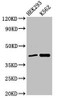 FANCF Antibody PACO52786