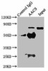 AACS Antibody PACO53954