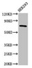 AACS Antibody PACO53954