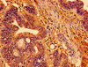 TSPO Antibody PACO54066