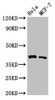 HLA-B Antibody PACO54122