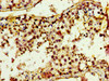 TRIM3 Antibody PACO55034