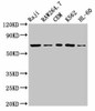 Zap70 Antibody PACO55834