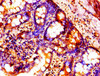 HIST1H1B Ab-66 Antibody PACO56632