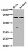 CLCNKB Antibody PACO57704
