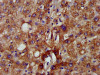 NADK2 Antibody PACO58184