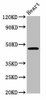 CERS3 Antibody PACO58268