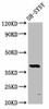 MKX Antibody PACO58284