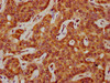 SAA2 Antibody PACO58885