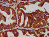 EVC2 Antibody PACO59181