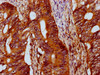 IFT172 Antibody PACO59501