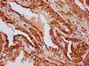 IFT172 Antibody PACO59501