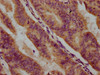 PPCDC Antibody PACO59860