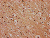 STH Antibody PACO59896