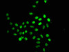 Crotonyl-HIST1H2BC K16 Antibody PACO60501