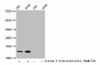 beta -hydroxybutyryl-HIST1H2BC K20 Antibody PACO60512