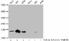 Glutaryl-HIST1H2BC K120 Antibody PACO60524