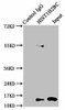 Butyrly-HIST1H2BC K5 Antibody PACO60590