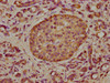 TCAF2 Antibody PACO60689