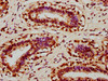 UVSSA Antibody PACO60733