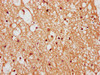 ZNF282 Antibody PACO60873
