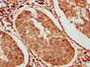 BICC1 Antibody PACO61454