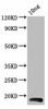BHRF1 Antibody PACO61786