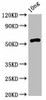 rsrIM Antibody PACO61794