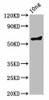 ompA Antibody PACO61838