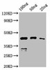 VP1 Antibody PACO61882