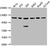 CDKL5 Antibody PACO61911