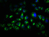 TRO Antibody PACO62391