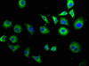 TPT1P8 Antibody PACO62827