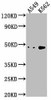 NKAPL Antibody PACO63099