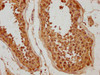 WDR92 Antibody PACO63163