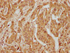 WFIKKN1 Antibody PACO63183