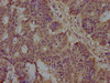 ST5 Antibody PACO63711