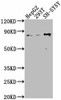 Uncharacterized protein Antibody PACO63739