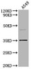 OR5V1 Antibody PACO64419