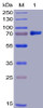 Human B7-H3 Recombinant Protein mFc-His Tag HDPT0012