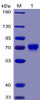 Human MSLN296-580 Recombinant Protein mFc-His Tag HDPT0031