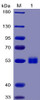 Human IL6 Recombinant Protein mFc-His Tag HDPT0032