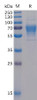 Human CD30 Ligand Recombinant Protein mFc-His Tag HDPT0038