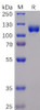 Human EPHA3 Recombinant Protein mFc-His Tag HDPT0042