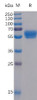 Human 4-1BB Ligand Recombinant Protein mFc-His Tag HDPT0045