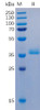 Human GPRC5D Recombinant Protein hFc-His Tag HDPT0051