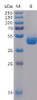 Human TIGIT Recombinant Protein hFc Tag HDPT0071